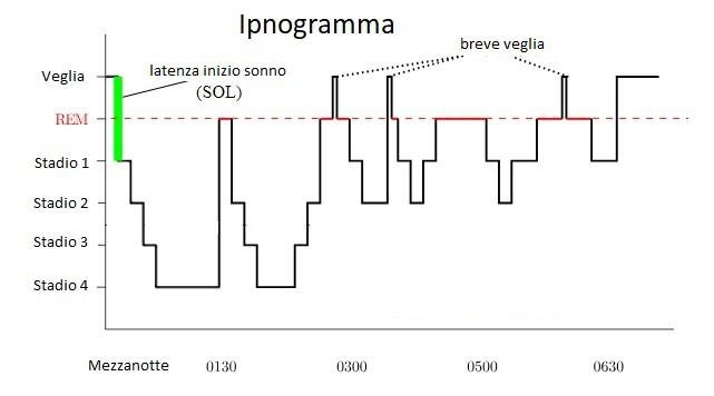 Ipnogramma stadi del sonno in relazione all'ora